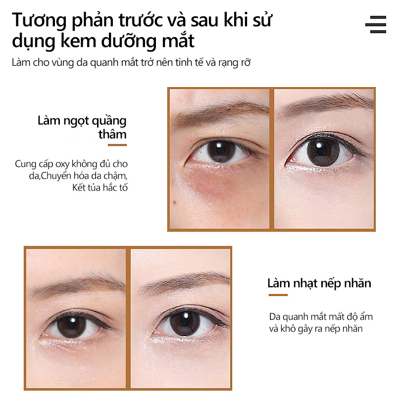👍🏻Chính Hãng👍🏻 Kem mắt Retinol A Ester Giảm Quầng Thâm Mắt , Chống Lão Hóa , Nâng Cơ Da Vùng Mắt 30g