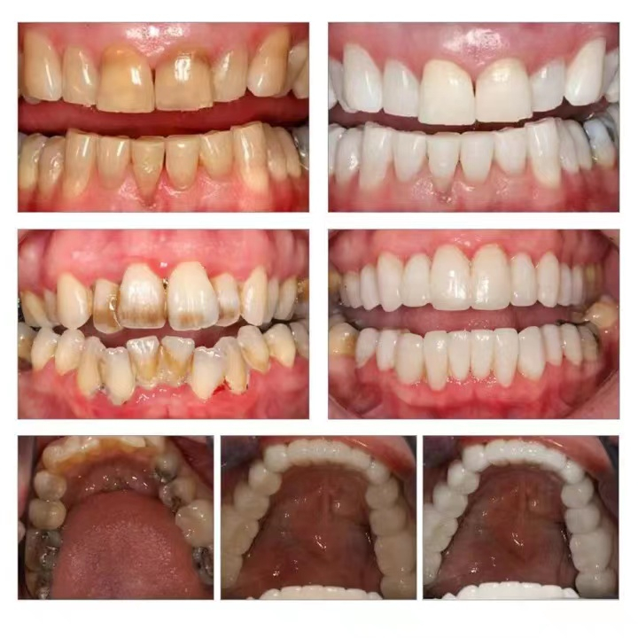 Kem đánh răng làm trắng làm trắng răng 250g  Giảm Vết Ố Vàng Trên Răng giảm sâu răng Giữ Hơi Thở Thơm Mát