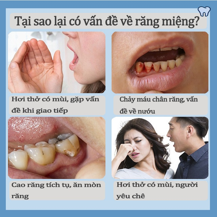 Kem đánh răng làm trắng làm trắng răng 250g  Giảm Vết Ố Vàng Trên Răng giảm sâu răng Giữ Hơi Thở Thơm Mát