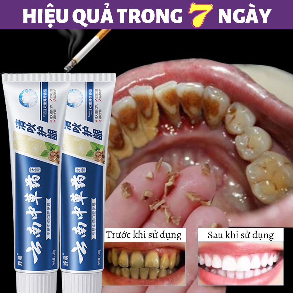 Kem đánh răng trắng răng vệ sinh răng miệng đánh răng kem đánh răng trị hôi miệng 180g Loại bỏ mảng bám và ngăn ngừa sâu răng Kem đánh răng thảo dược Công thức hoàn toàn tự nhiên