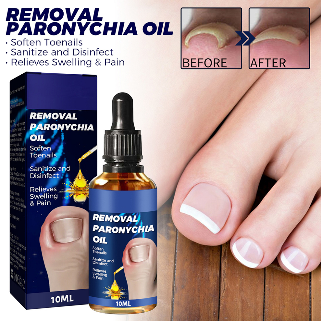 Tinh Dầu Paronychia 10ML Hỗ Trợ Giảm Bệnh Nấm Móng Và Móng Chân