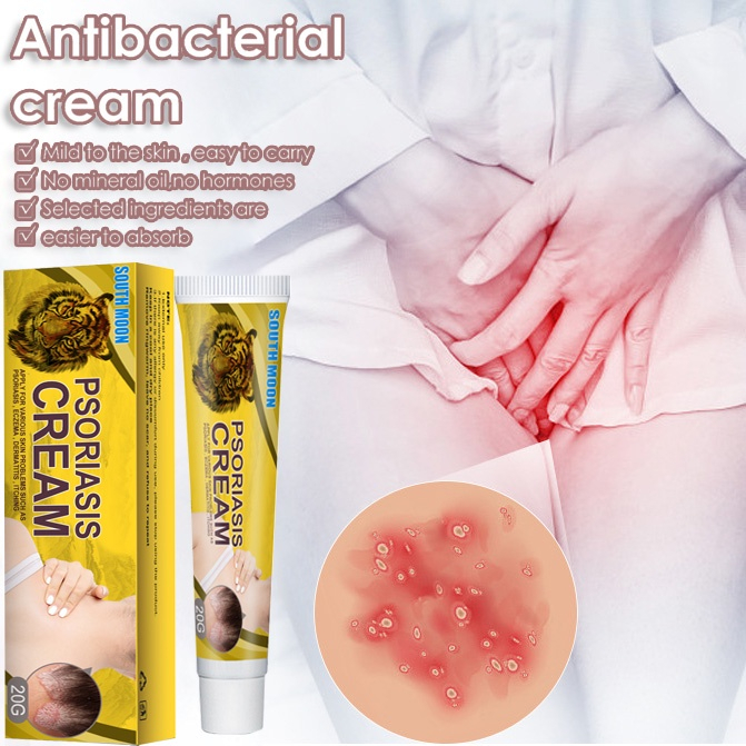 Kem bôi Bôi ngứa kem bôi hắc lào Kem bôi vảy nến kem kháng khuẩn 20g kem thảo dược tự nhiên làm giảm nhiễm giảm v.i.ê.m lỗ chân lông v.i.ê.m da cơ địa chàm da mề đay vảy nến á sừng chàm sữa hắc