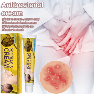Kem bôi Bôi ngứa kem bôi hắc lào Kem bôi vảy nến kem kháng khuẩn 20g kem thảo dược tự nhiên làm giảm nhiễm giảm v.i.ê.m lỗ chân lông v.i.ê.m da cơ địa chàm da mề đay vảy nến á sừng chàm sữa hắc