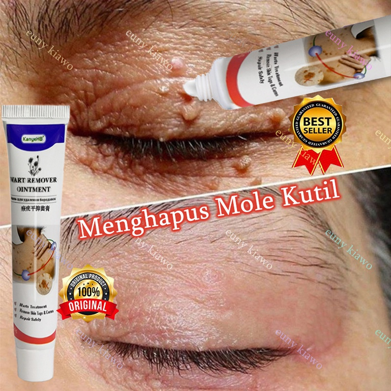 Kem loại bỏ mụn cóc SWEN chiết xuất từ thành phần tự nhiên thẩm thấu sâu phù hợp cho unisex mụn cóc sinh dục mụn cóc thông thường mụn cơm phẳng