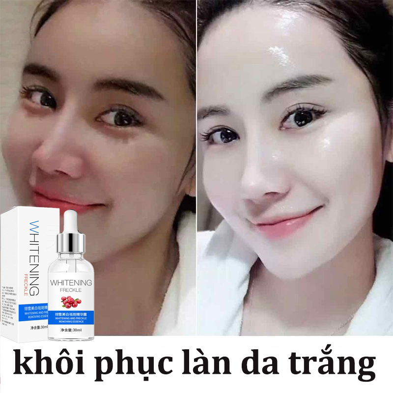 ⚡ GÌ CŨNG RẺ ⚡Tinh chất làm trắng 30ml tinh chất trắng da Nicotinamide làm trắng da mặt sáng da dưỡng ẩm chống lão hóa serum làm trắng