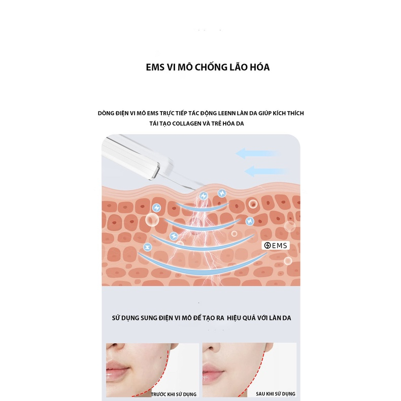Máy Làm Sạch Lỗ Chân Lông Loại Bỏ Mụn Đầu Đen ion Âm Tẩy Tế Bào Chết EMS Làm Săn Chắc Da Mặt