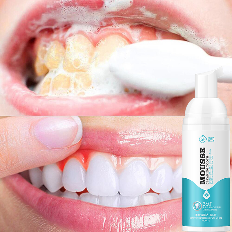 Kem Đánh Răng 60ml Loại Bỏ Vết Bẩn Chăm Sóc Răng Miệng