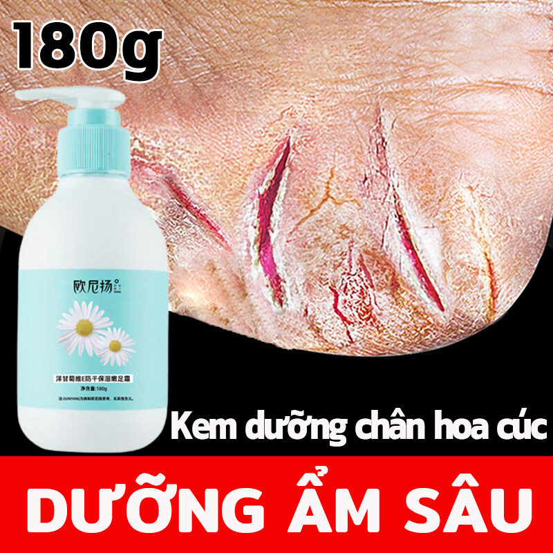 Kem dưỡng chân hoa cúc Kem dưỡng da tay Kem Chống Nẻ 180g Dưỡng Ẩm Chống Nẻ Da Tay Chân á sừng Bong da Nứt Gót Chân