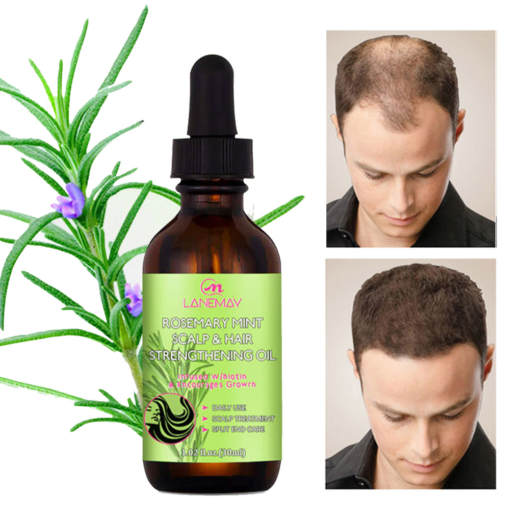 Dầu hương thảo cho tóc Dầu hương thảo hữu cơ cho da đầu & tóc chắc khỏe 1 Fl. Oz Rosemary Oil With Biotin & Essential Oils, Tinh dầu dưỡng cho tóc chẻ ngọn và da đầu khô