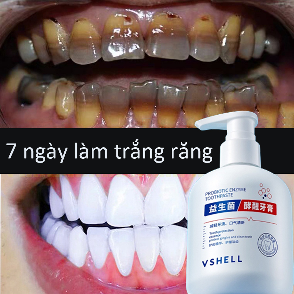 Giảm Vết Ố Vàng Trên Răng giảm sâu răng Giữ Hơi Thở Thơm Mát