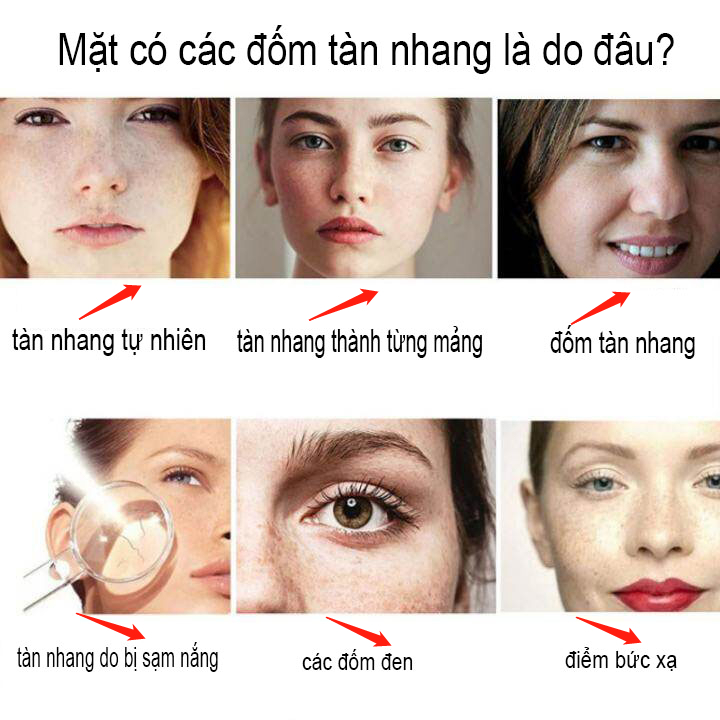 kem nám tàn nhang 50ML Serum trắng da và loại bỏ đốm nám tàn nhang Làm mờ vết thâm hiệu quả Chống lão hóa Làm trắng và sáng