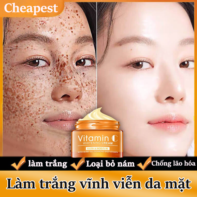 ⚡ GÌ CŨNG RẺ ⚡Kem bôi trắng da mặt kem tẩy trắng da cấp tốc xóa vết thâm nám,vết chân chim, làm mờ hắc tố, làm trắng da, kem trị nám tàn nhang