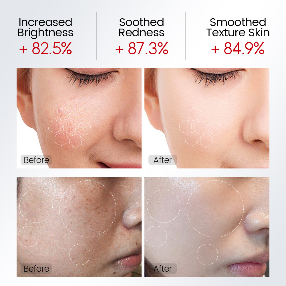 Bộ 4 Sản Phẩm Làm Trắng Da VIBRANT GLAMOUR FDA Niacinamide 8% Kem + 5% Serum + 2% Dưỡng Ẩm 5 Loại Tùy Chọn