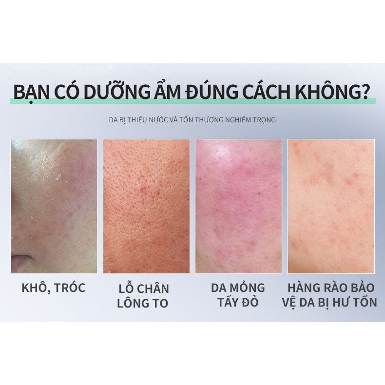 Serum vitamin B5 centella DELEVENTH phục hồi dưỡng ẩm chống dị ứng（30ml）