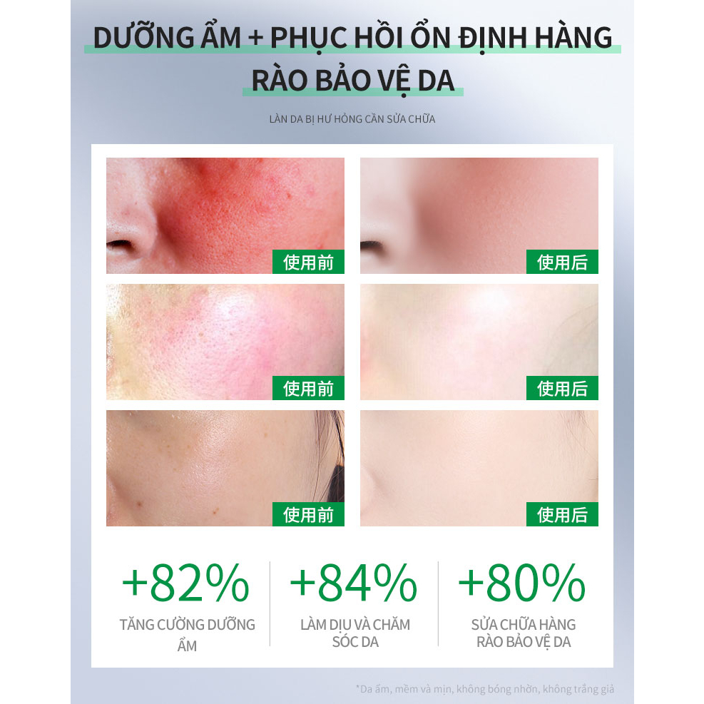 Serum vitamin B5 centella DELEVENTH phục hồi dưỡng ẩm chống dị ứng（30ml）