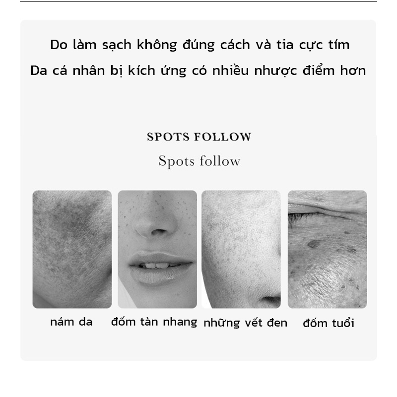 Tinh chất làm trắng sạch tàn nhang Serum thâm nám  Serum trắng da và xóa tàn nhang 30ml Hiệu quả làm mờ thâm nám tàn nhan, nám da，cháy nắng，làm trắng da mặt，Da Săn Chắc Mịn Màng Dưỡng