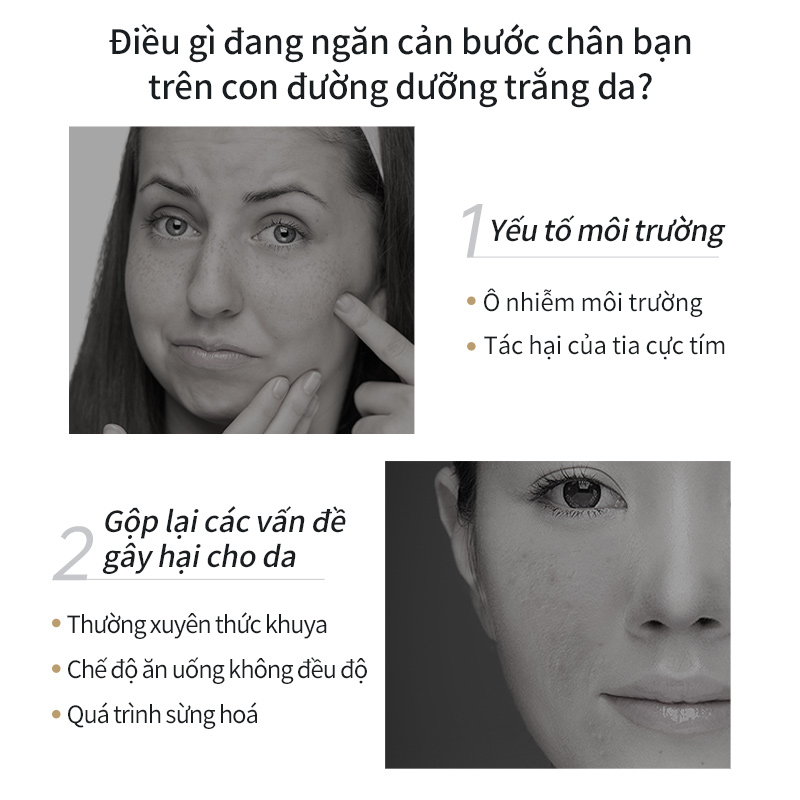 Mặt nạ đất sét MASKFAMILY làm sáng da/ mờ thâm nám/ giảm sắc tố melanin giúp da sáng trắng chăm sóc da mặt 80g