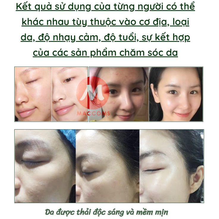 Mặt Nạ Ngủ Collagen Dưỡng Ẩm Làm Trắng Da Chống Lão Hóa Giúp Da Căng Bóng Trẻ Hóa Làn Da