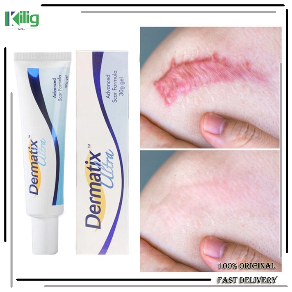 Kem Hỗ trợ giảm sẹo Và Vết Rạn Da Dermatix 15g