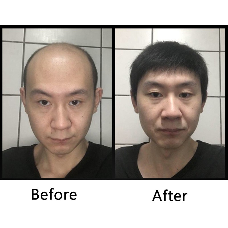 Đầu tóc giả thay thế dạng ngắn thoáng khí cho nam Bộ Tóc Giả Ngắn Thời Trang Dành Cho NamChâu Phi Hành Đoàn