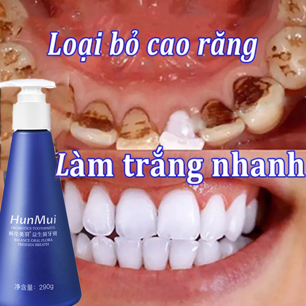 Kem đánh răng làm trắng giảm ố vàng hết hôi miệng Giúp Làm Trắng Răng Loại Bỏ Các Vết Ố Các Vi Khuẩn Có Hại Cho Răng290g