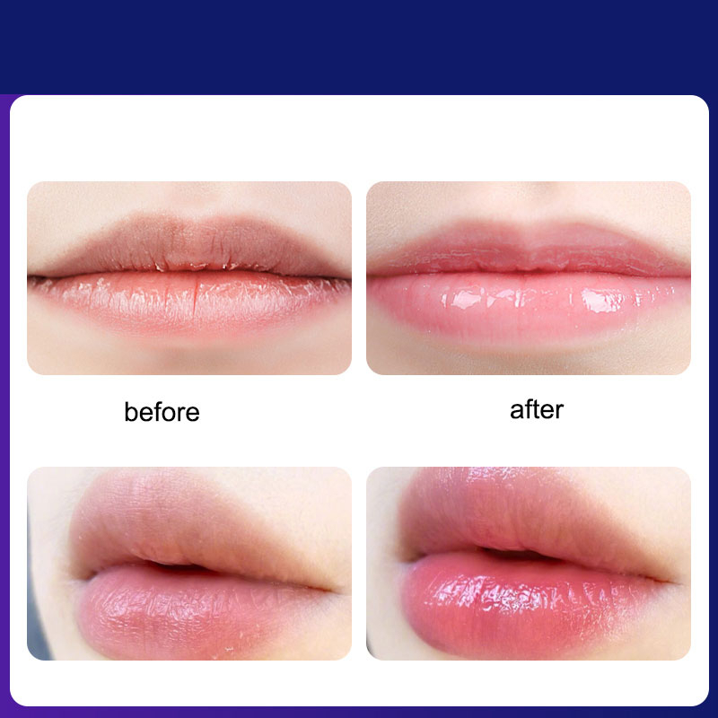Mặt Nạ Môi Vaseline Kỹ Thuật Số Dưỡng Ẩm Hydrat Hóa Làm Sáng Màu Môi  No. 3, No. 4, No. 5, No. 6