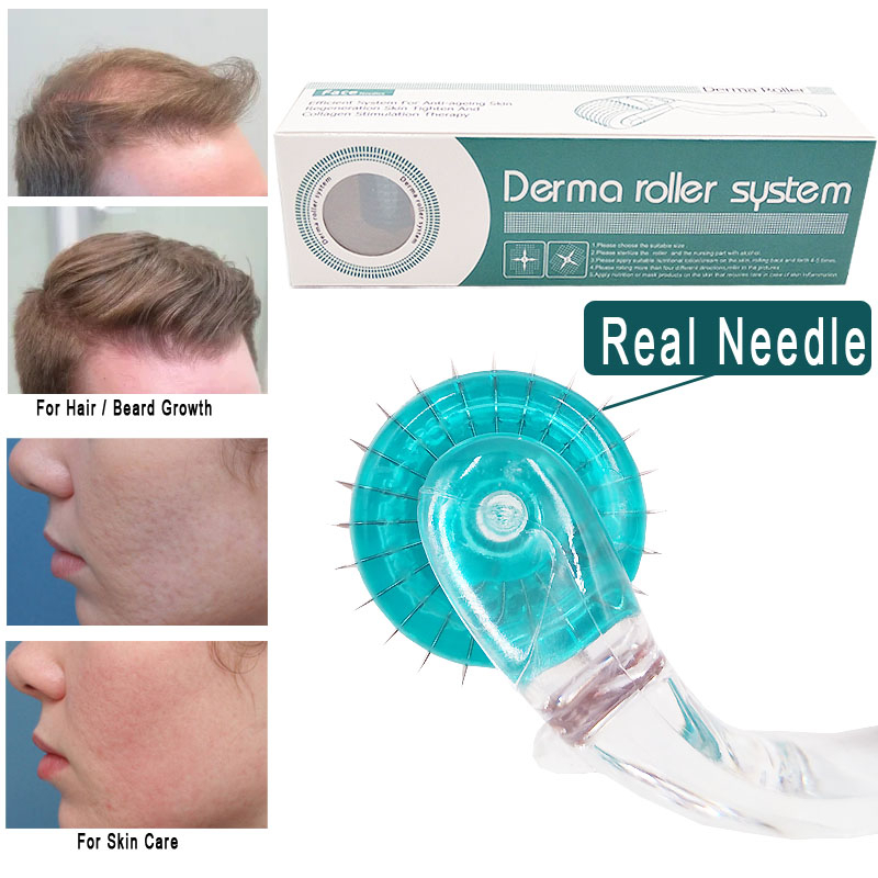 Cây Lăn Vi Kim 192 Chăm Sóc Và Kích Thích Mọc Tóc