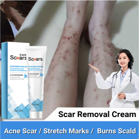 Kem Hỗ trợ giảm sẹo Làm Sáng Da Màu Sắc Tươi Tắn