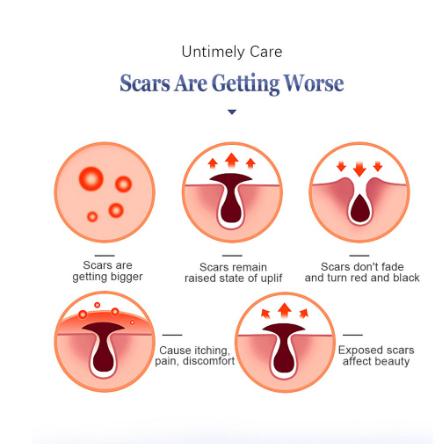 Kem Hỗ trợ giảm sẹo Làm Sáng Da Màu Sắc Tươi Tắn