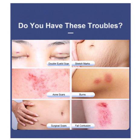 Kem Hỗ trợ giảm sẹo Làm Sáng Da Màu Sắc Tươi Tắn