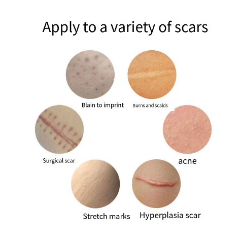 Kem Hỗ trợ giảm sẹo Làm Sáng Da Màu Sắc Tươi Tắn