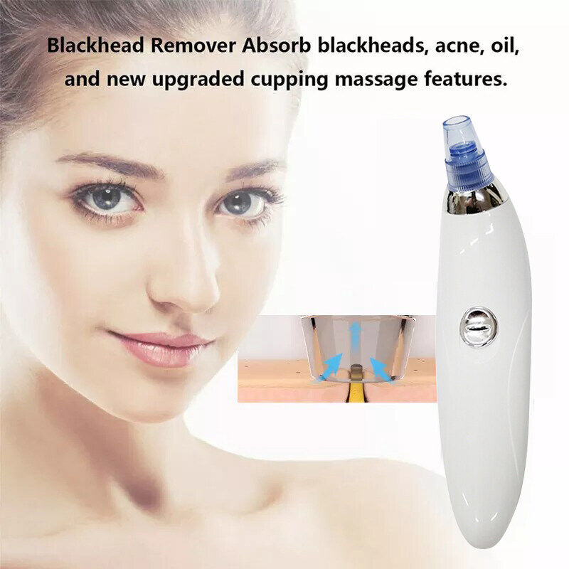 Máy Hút Mụn Đầu Đen Làm Sạch Sâu Lỗ Chân Lông Đa Năng Kèm 4 Đầu Thay Thế