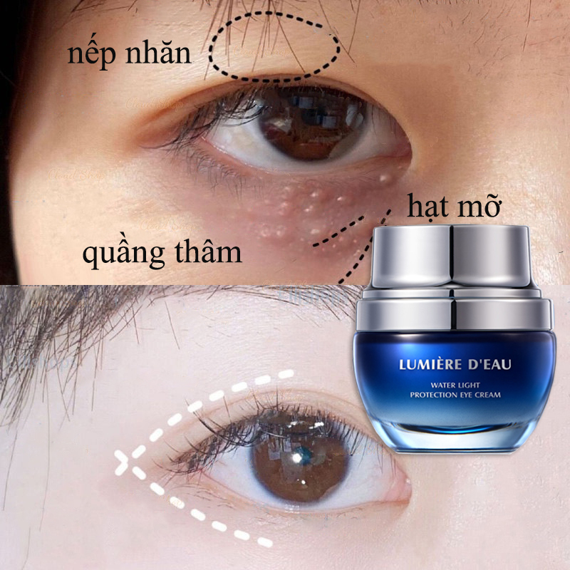 👍🏻Chính Hãng👍🏻 Kem Mắt Chống Lão Hóa Glowing Eye Cream 30G Loại Bỏ Bọng Mắt Quầng Thâm Chống Nhăn Chống Lão Hóa Dưỡng Ẩm Làm Săn Chắc Da Sáng