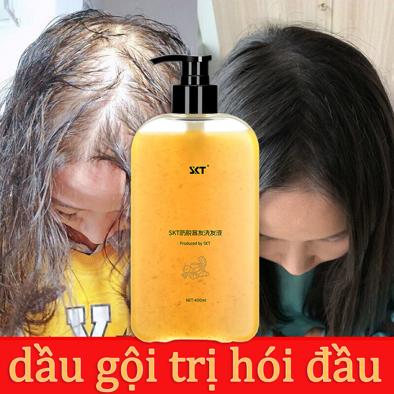 ??Chính Hãng?? Dầu Gội Gừng, Dầu Gội Mọc Tóc, Dầu Gội Đầu Làm Rậm Tóc Thảo Dược Dưỡng Sinh Kiểm Soát Dầu Loại Bỏ Gàu 400Ml Kích Thích Mọc Tóc Tươi Mát Chống Dầu Gốc Tóc Vững Chắc Và Tóc Khỏe Mạnh