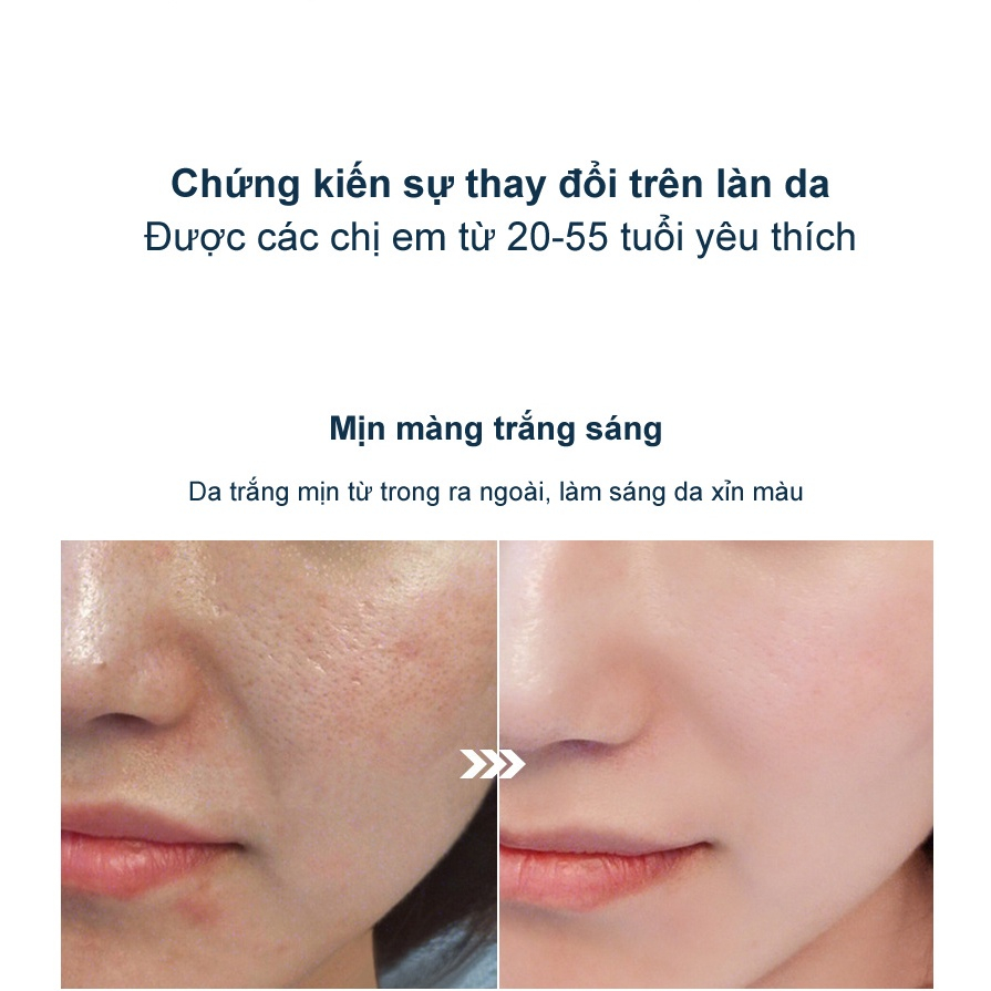 Tinh chất làm trắng dưỡng ẩm mặt 30ml tinh chất trắng da Nicotinamide làm trắng da mặt sáng da dưỡng ẩm chống lão hóa serum