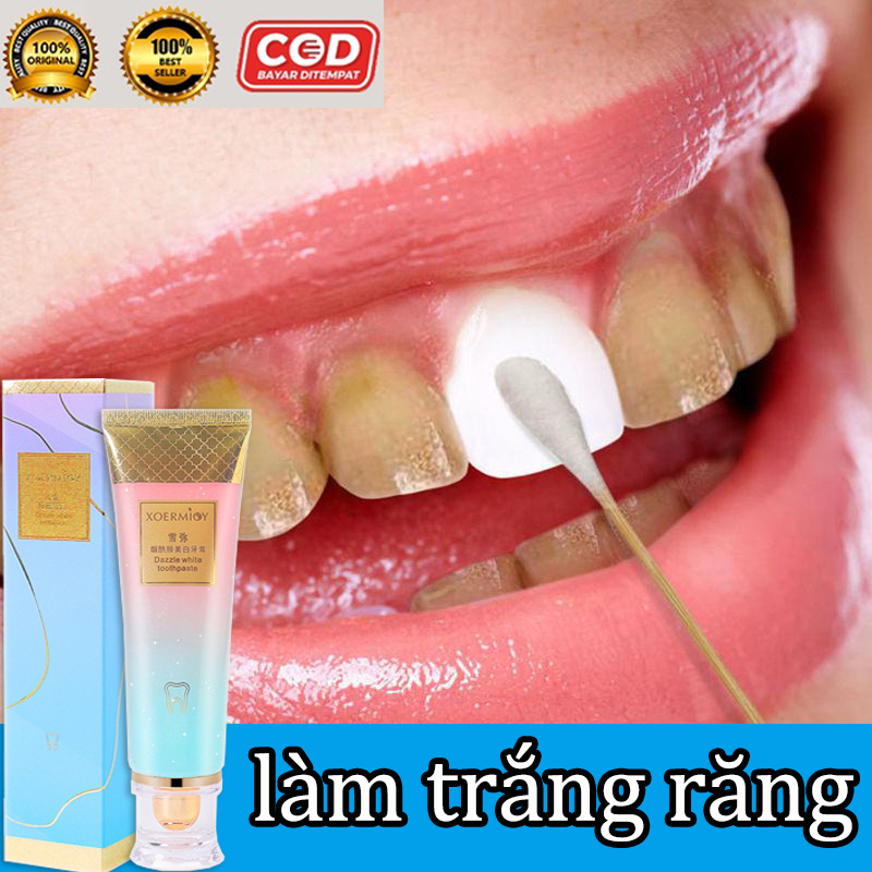 👍🏻Chính Hãng👍🏻 Kem đánh răng làm trắng răng Ubat Gigi Kem đánh răng làm trắng Gigi Putih Kem đánh răng trắng răng Niacinamide Hơi thở thơm mát 100g