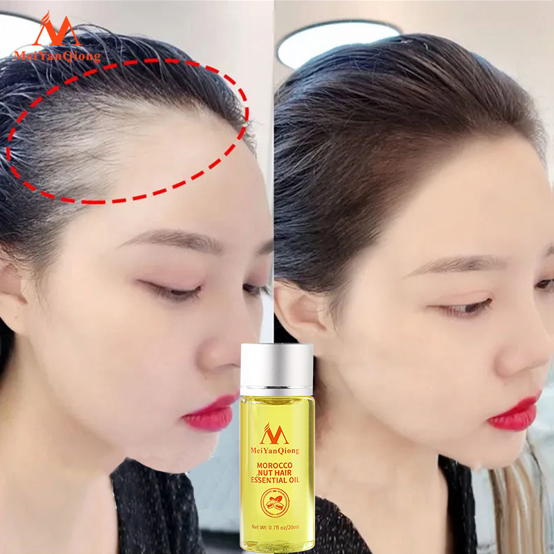 Tinh dầu kích thích mọc tóc MeiYanQiong chiết xuất hạt Ma Rốc chăm sóc hiệu quả giúp mọc tóc phục hồi tóc hư tổn giữ nếp tạo nếp tóc mềm 20ml