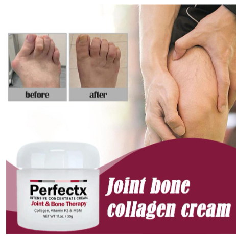 Kem Hỗ Trợ Giảm Đau Khớp Và Xương Khớp Chân 30g