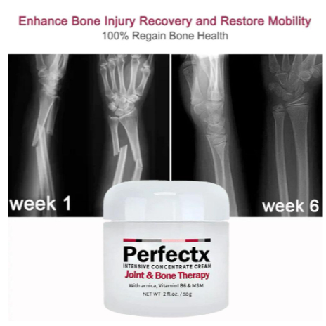 Kem Hỗ Trợ Giảm Đau Khớp Và Xương Khớp Chân 30g