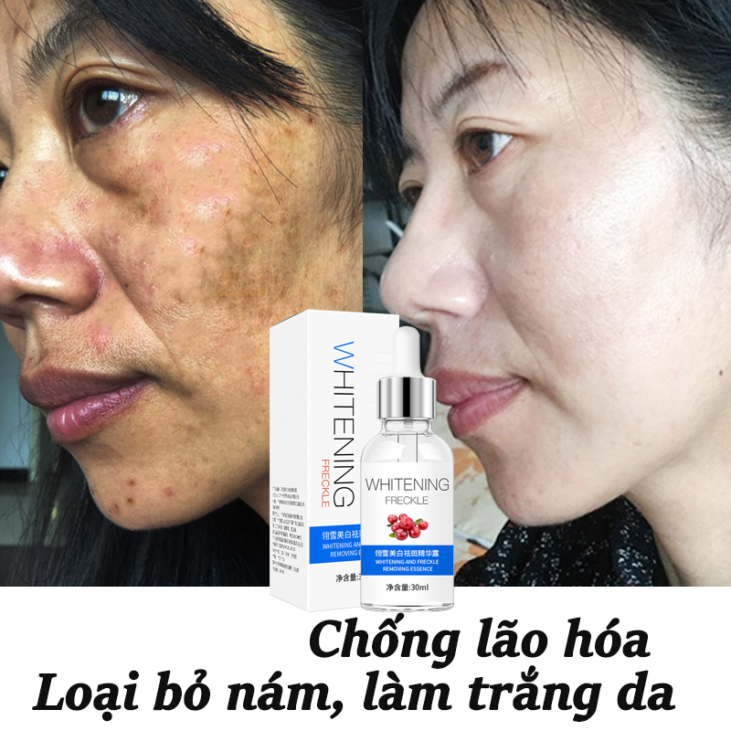 ⚡ GÌ CŨNG RẺ ⚡Tinh chất làm trắng 30ml tinh chất trắng da Nicotinamide làm trắng da mặt sáng da dưỡng ẩm chống lão hóa serum làm trắng