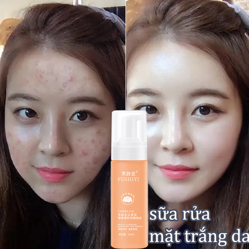 👍🏻Chính Hãng👍🏻 Camellia Amino Acid Làm sạch Mousse,Cải thiện làn da mụn，sữa rửa mặt thu nhỏ lỗ chân lông 150ml  làm sạch da mặt nhẹ nhàng, dưỡng ẩm kiềm dầu loại bỏ mụn, không căng da, loại bỏ tế bào chết, làm sạch da mặt tầng sâu