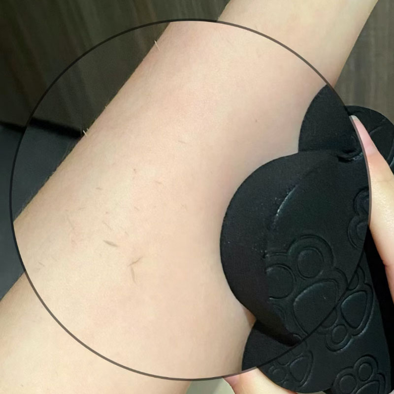 Gel Tắm Tẩy Tế Bào Chết Dưỡng Ẩm Chứa Axit Azelaic 330ml IS Azelaic