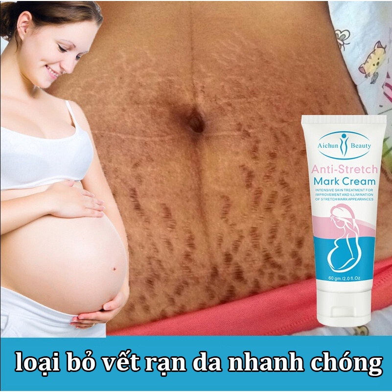 ⭐CHÍNH HÃNG⭐ kem xóa sẹo mờ vết rạn da giảm sẹo 60g Chống rạn da Chống nếp nhăn do giảm cân Sửa chữa tổn thương da