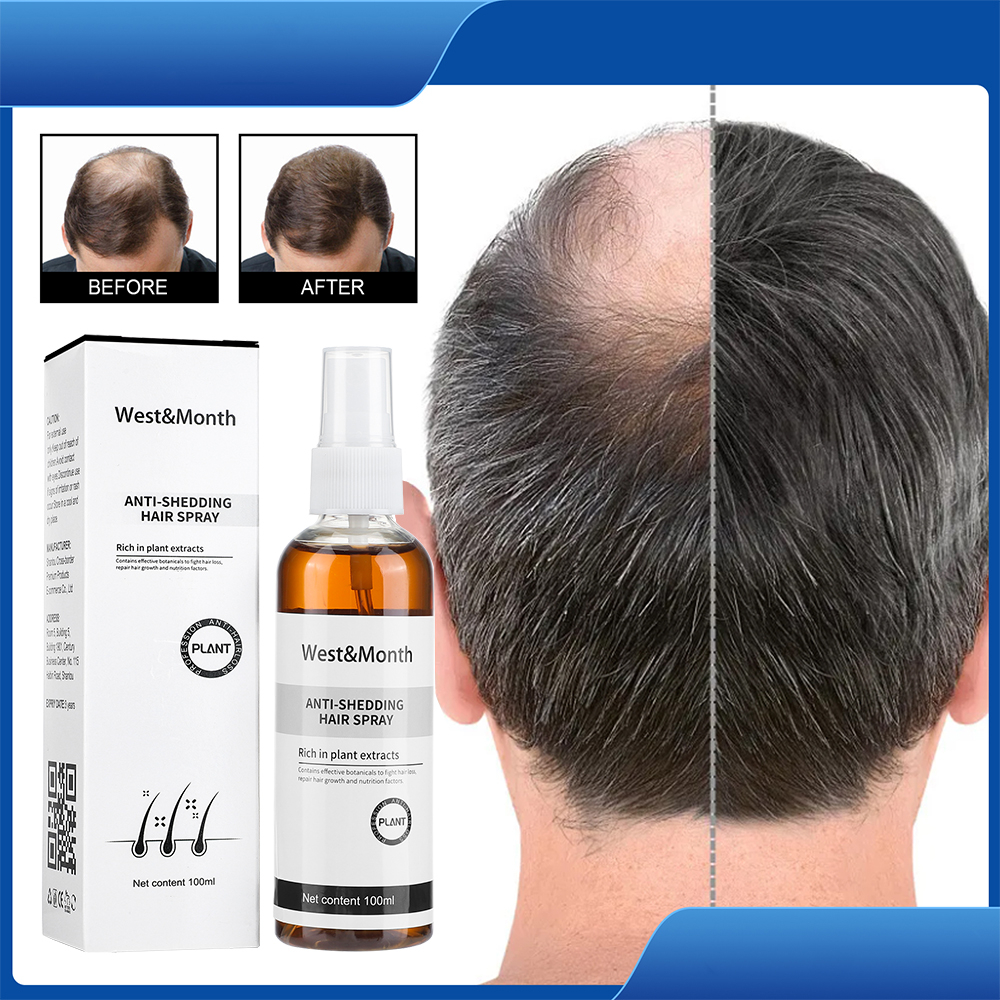 Chai Xịt Kích Thích Mọc Tóc Chống Rụng Tóc Dưỡng Ẩm Cải Thiện Tình Trạng Rụng Tóc