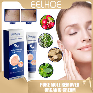 Kem Trị Mụn Cóc Thành Phần Tự Nhiên Và Kháng Khuẩn 20g