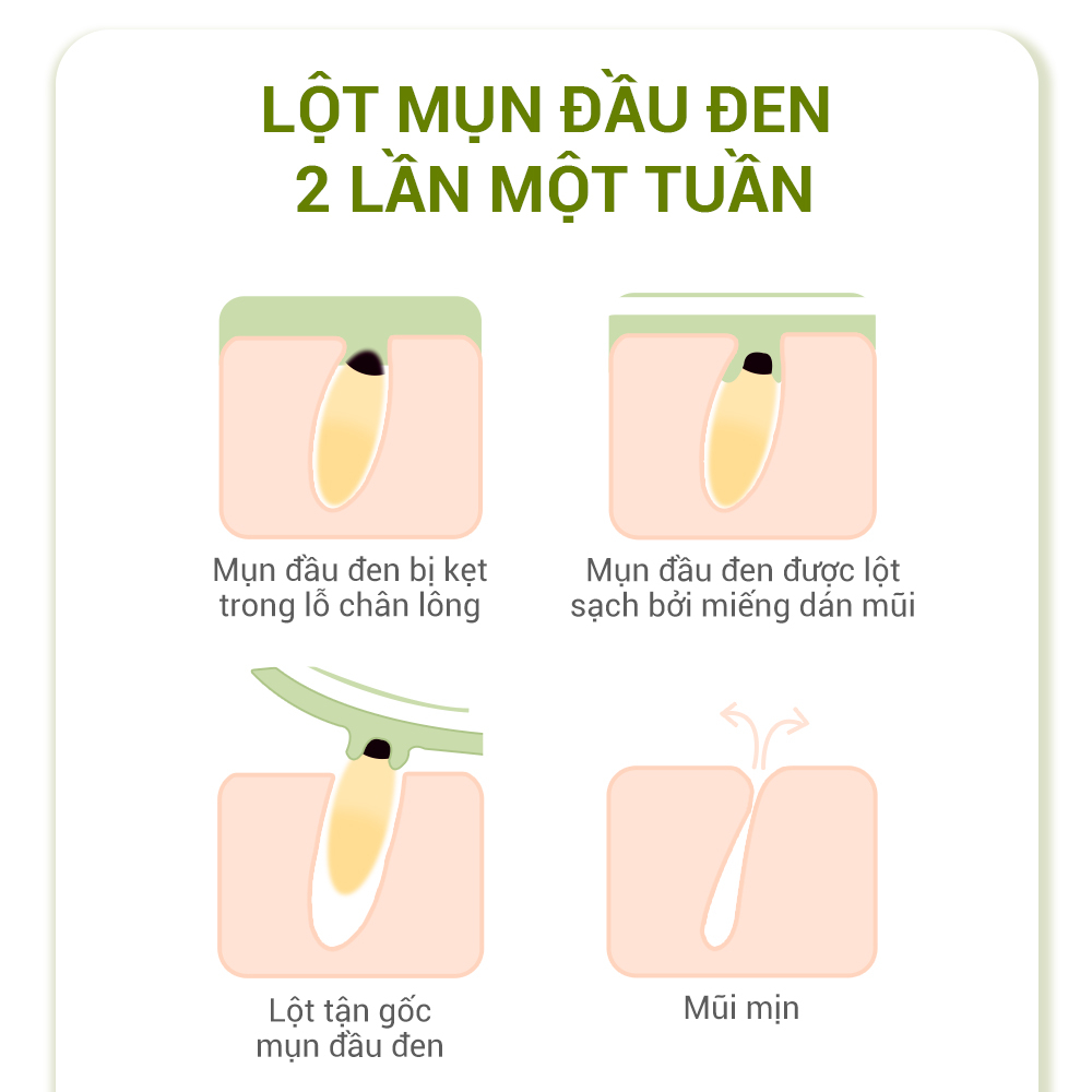 Miếng Dán Mũi Làm Sạch Sâu Breylee Chăm Sóc Da Hiệu Quả 5PCS