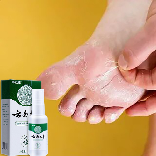 👍🏻Chính Hãng👍🏻 Xịt thảo dược diệt khuẩn chân Athlete Beriberi net, xịt kháng khuẩn thảo dược 30ml bình xịt chăm sóc chân bình xịt chân bình xịt chăm sóc chân cho bàn chân của vận động viên