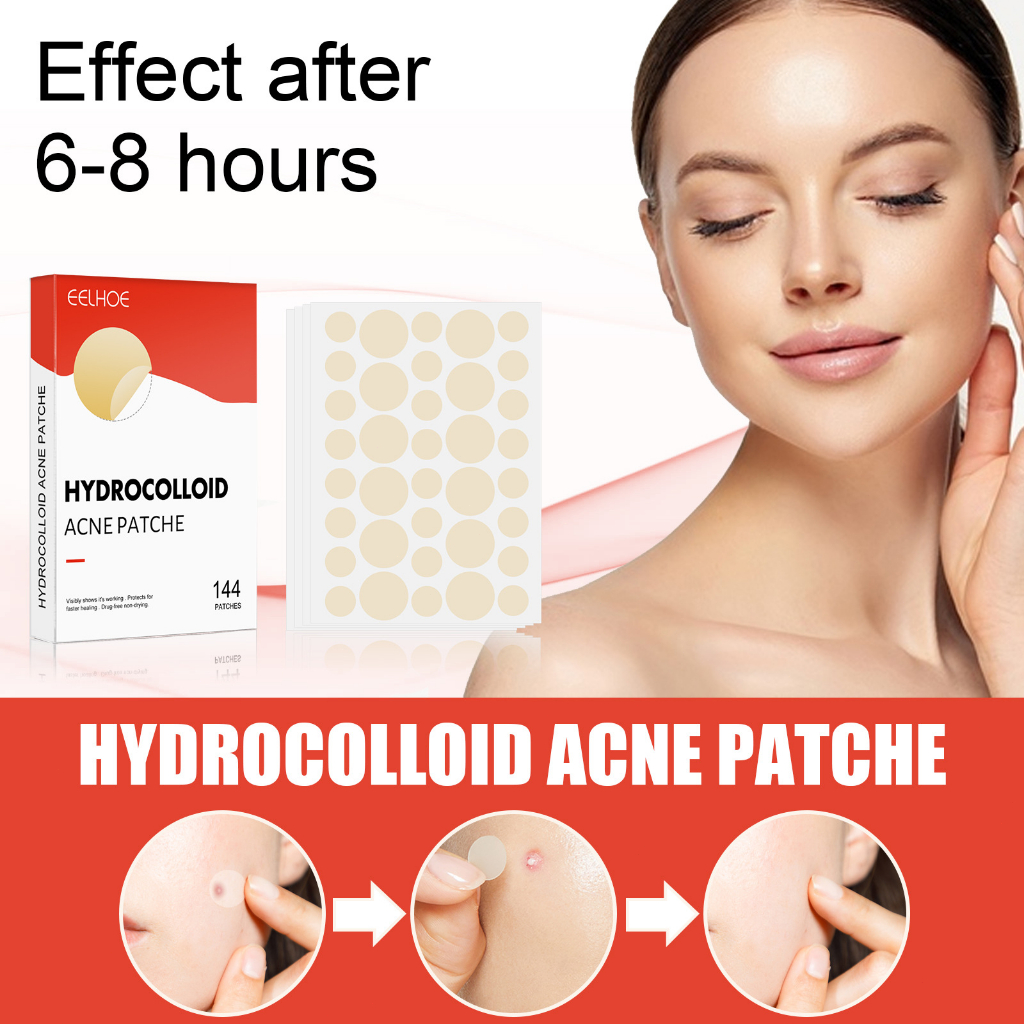 Miếng Dán Hỗ trợ giảm mụn Lewedo Hydrocolloid Vô Hình Thoáng Khí Chống Thấm Nước