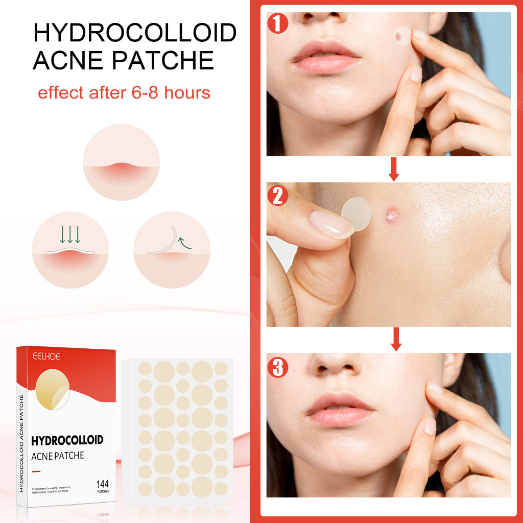 Miếng Dán Hỗ trợ giảm mụn Lewedo Hydrocolloid Vô Hình Thoáng Khí Chống Thấm Nước