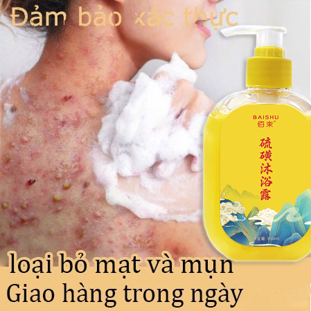 ⭐CHÍNH HÃNG⭐ Sữa tắm, sữa tắm mụn lưng,sữa tắm trắng da sữa tắm viêm nang lông 400ML trắng da loại bỏ mụn lưng, nang lông,sạch nhờn kiềm dầu hiệu quả